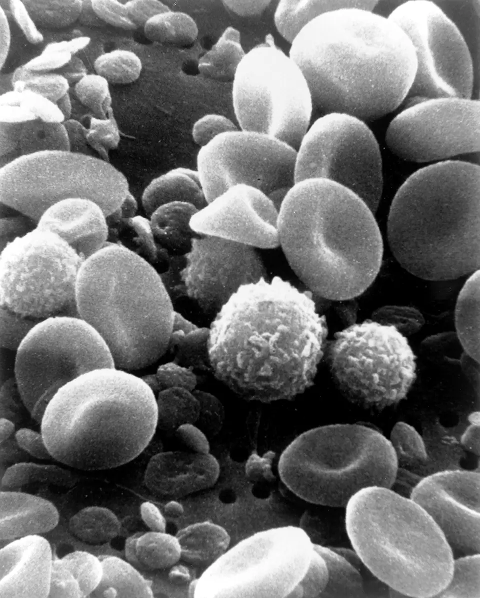 Glóbulos rojos, glóbulos blancos y plaquetas vistos al microscopio electrónico de barrido