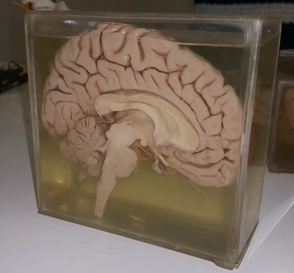 Medio cerebro humano cortado por la mitad, conservado en un recipiente de vidrio con líquido