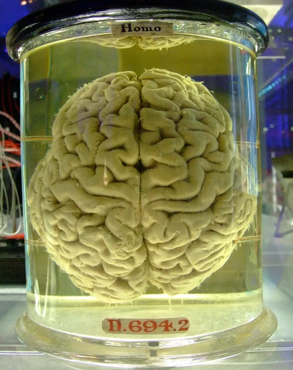 Cerebro humano conservado en un frasco de vidrio, visto desde arriba: la cisura del medio lo separa en dos hemisferios