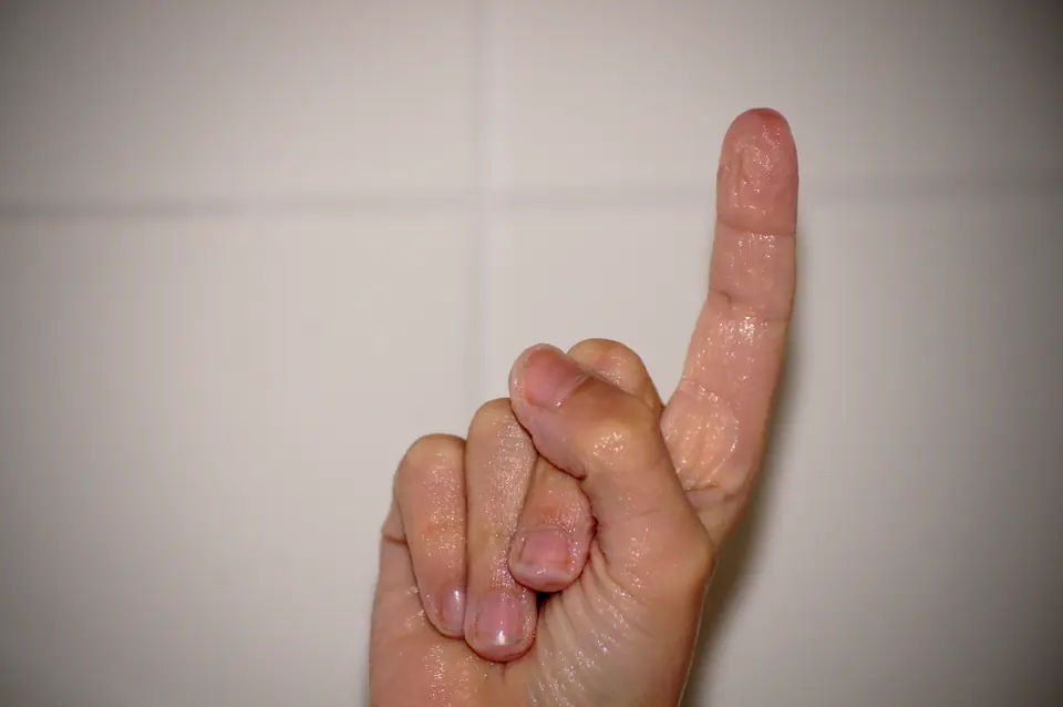 Mano con las yemas de los dedos arrugadas después de estar un rato en el agua